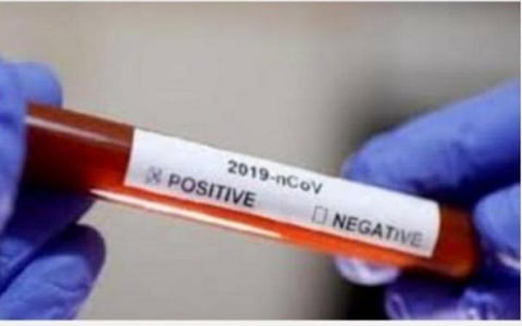 கரோனா உயிரிழப்பு; இந்தியாவில் 2.82 சதவீதம் மட்டுமே: மத்திய அரசு அறிவிப்பு