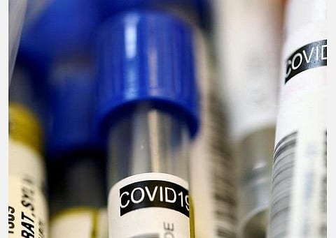 ஆண்டு இறுதிக்குள் 100 மில். டோஸ் வாக்சைன் தேவைப்படும் நிலை: அமெரிக்காவில் ஒரே நாளில் 15,846 பேருக்கு கோவிட்-19 தொற்று