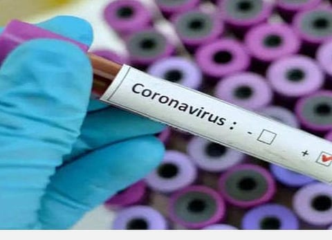 பிரதிநிதித்துவப்படம்