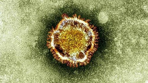 கோவிட்-19 பாதிப்பு: பாலிவுட் தயாரிப்பாளர் அனில் சூரி காலமானார்