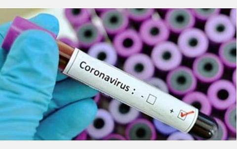 கரோனாவால் இறந்தவரின் உடலை கையாண்டதில் அலட்சியம் ஏன்?- விளக்கம் கேட்டு ஆட்சியர் நோட்டீஸ்