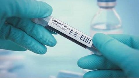 சென்னை சென்று வந்த மதுரை போக்குவரத்துக் கழக மேலாளருக்கு கரோனா