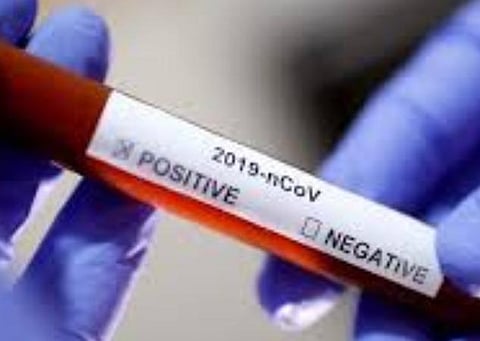 பிரதிநிதித்துவப் படம்