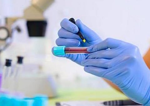 பிரதிநிதித்துவப் படம்