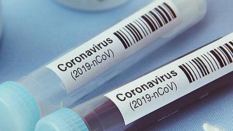 வெளியூர்களில் இருந்து வந்த நபர்களுக்கு ‘காய்ச்சல்’ இருக்கிறதா?- மதுரை மாநகராட்சியில் வீடு, வீடாக கணக்கெடுப்பு