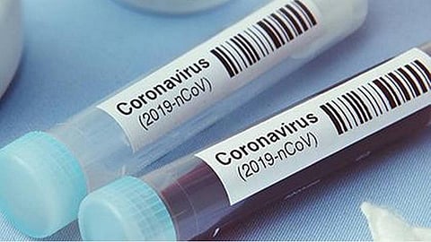 மதுரையில் கரோனா பரிசோதனையை அதிகரிக்க வேண்டும்: பாஜக மாநில செயலர் வலியுறுத்தல்