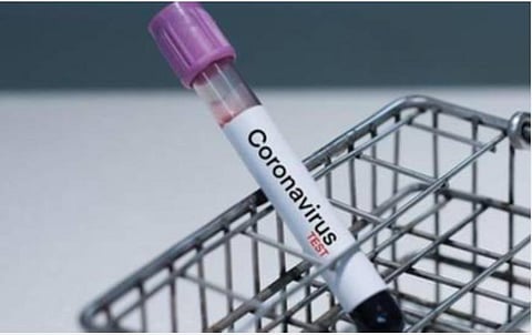 சாதாரண காய்ச்சல் போன்றதுதான்; கரோனாவை தைரியமாக எதிர்கொள்ளலாம்- நம்பிக்கையூட்டும் குணமடைந்த இளைஞர்