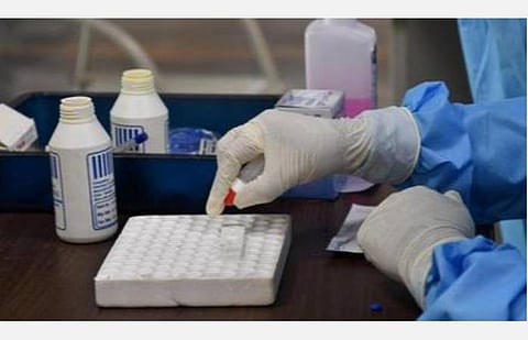 தர ஆய்வுக்குப் பிறகே ரேபிட் டெஸ்ட் கிட் பயன்படுத்த வேண்டும்: பொதுநல வழக்கை முடித்து வைத்தது உயர் நீதிமன்றம்