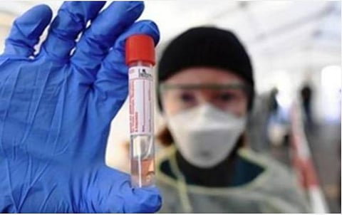 மதுரையில் கரோனா பரிசோதனை முடிவுகள் மறைக்கப்படுகின்றனவா?- சுகாதாரத் துறை மீது திடீர் குற்றச்சாட்டு