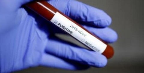 ஒரே குடும்பத்தைச் சேர்ந்த மூதாட்டி உட்பட 3 பேர் உயிரிழப்பு: கரோனா காரணமா?