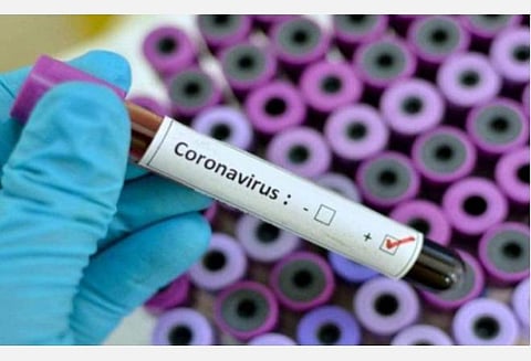 அரசு மருத்துவமனைக்கு தாமதமாக ‘கரோனா’ நோயாளிகளை பரிந்துரை செய்யக்கூடாது: தனியார் மருத்துவமனைகளுக்கு ‘கரோனா’ தடுப்பு சிறப்பு அதிகாரி எச்சரிக்கை