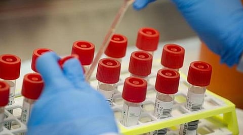 செங்கல்பட்டு மாவட்டத்தில் ஒரேநாளில் 330 பேருக்கு கரோனா பாதிப்பு