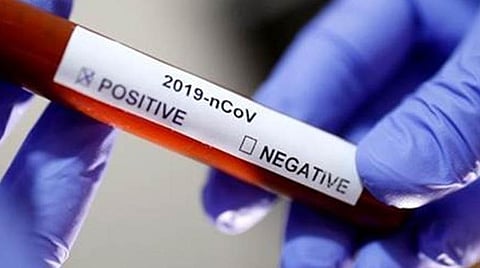 உயிரிழந்த பெண்ணுக்கு கரோனா: இறுதிச் சடங்கில் பங்கேற்றோர் அச்சம்