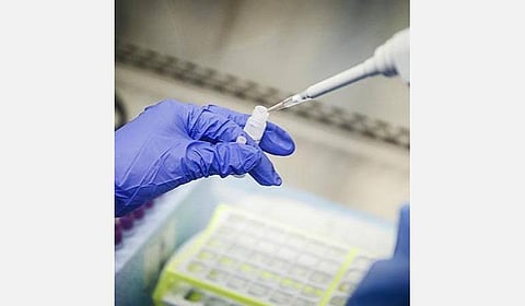 மாநகராட்சி அதிகாரிக்கு கரோனா: 150 ஊழியர்களுக்கு பரிசோதனை