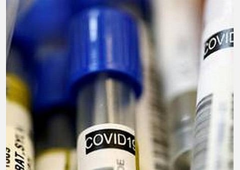 பிரேசிலை ஆட்டிப்படைக்கும் கரோனா: பலி எண்ணிக்கை 72,000 என்ற எண்ணிக்கையை கடந்தது