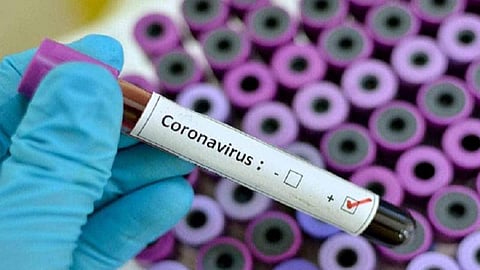 ராஜபாளையம் தொகுதி திமுக எம்.எல்.ஏ.வுக்கு கரோனா: தனியார் மருத்துவமனையில் சிகிச்சை