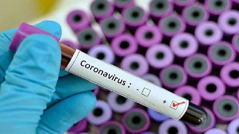 விருதுநகரில் உச்சத்தை எட்டும் கரோனா: இன்று ஒரே நாளில் 480 பேர் பாதிப்பு