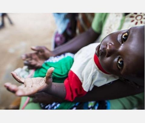 ஆண்டுக்கு 1,28,000 குழந்தைகள் இறப்பார்கள்; பட்டினி சிகப்பு மண்டலத்தில் ஆப்கான்; புற்களை தின்னும் மனிதர்கள்: ஐ.நா வேதனை