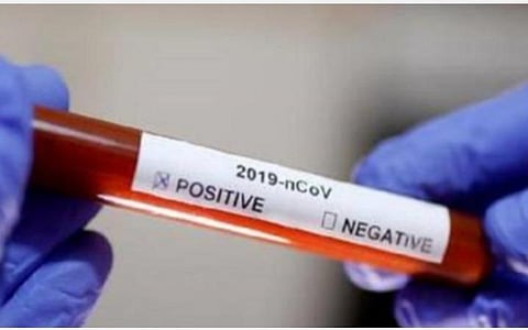 ஒரே நாளில் 6 லட்சம் பேருக்கு கரோனா பரிசோதனை: தொடர்ந்து 4-வது நாளாக நடவடிக்கை