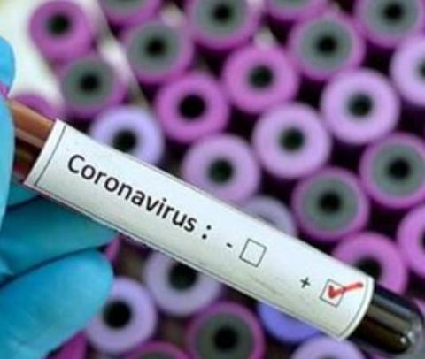 பிரதிநிதித்துவப் படம்