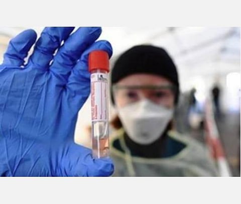 ஏற்கெனவே இருக்கும் டி-செல்கள் நினைவுப் பதிவு தொற்றின் தீவிரத்தை குறைக்கலாமே தவிர கரோனாவை தடுக்காது- ஆய்வில் தகவல்