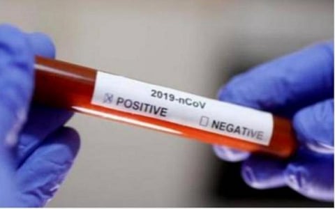 இந்தியாவில் கரோனா இறப்பு விகிதம்; 1.76 சதவீதமாக குறைந்தது