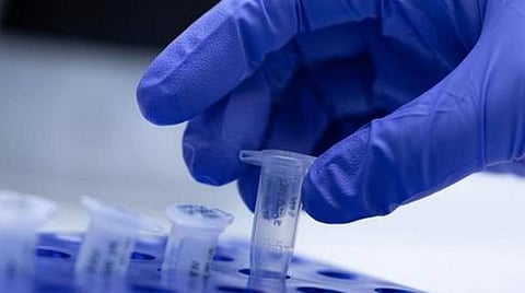 பிரதிநிதித்துவப் படம்