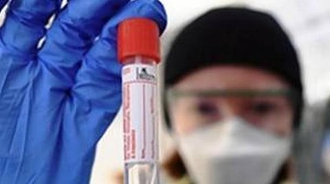 இந்தியாவில் கரோனா பாதிப்பு எண்ணிக்கை 42 லட்சத்தைக் கடந்தது; ஒரே நாளில் 90,802 பேர் பாதிப்பு