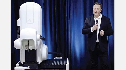 வந்துவிட்டது மூளையை இயக்கும் சிப்