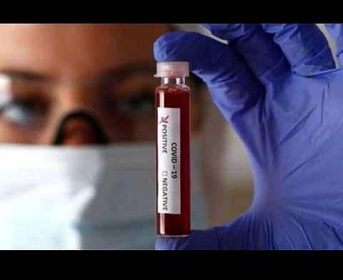 கோப்புப்படம்