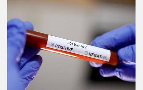 அரசு நிர்ணயித்த கட்டணத்தைவிட கூடுதலாக வசூலிப்பு; தனியார் மருத்துவமனை சென்றாலே கரோனா பாசிட்டிவ்?-பரிசோதனையை தவிர்க்கும் பொதுமக்கள்