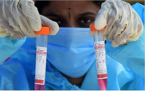 நவ.17 சென்னை நிலவரம்; கரோனா தொற்றிலிருந்து மீண்டவர்கள், சிகிச்சையில் இருப்பவர்கள்: மண்டல வாரியான பட்டியல்