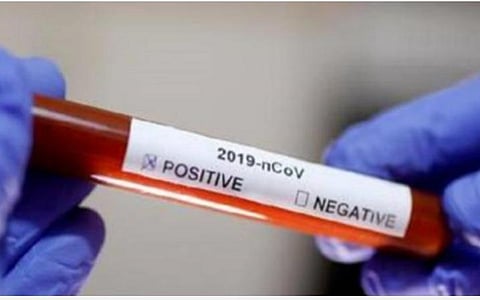 13 கோடி பரிசோதனைகளை மேற்கொண்டு இந்தியா சாதனை