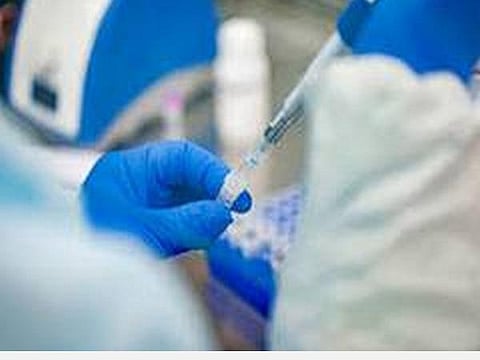 பிரதிநிதித்துவப் படம்.