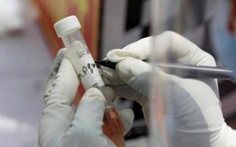 உருமாறிய கரோனா தொற்று; இந்தியாவில் 102 பேர் பாதிப்பு