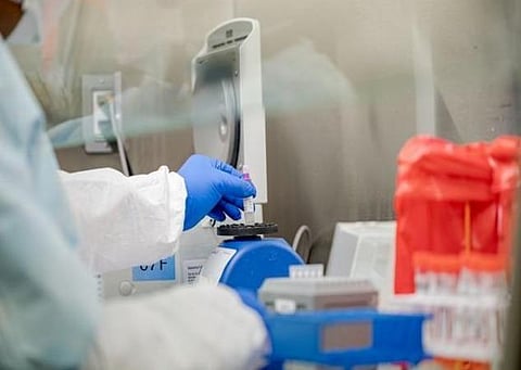 புதிய உச்சம்; கரோனா பரிசோதனை எண்ணிக்கை 20 கோடியை தாண்டியது