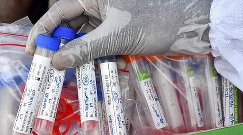 ஜூன் 6 சென்னை நிலவரம்; கரோனா தொற்றிலிருந்து மீண்டவர்கள், சிகிச்சையில் இருப்பவர்கள்: மண்டல வாரியான பட்டியல்