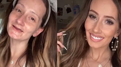 செயற்கைப் பல் இல்லை, கண் இமைகள் இல்லை: அசல் அழகில் ஜொலிக்கும் டிக்டாக் நட்சத்திரம்