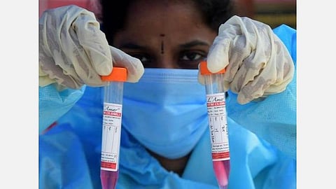 ஜூன் 27 சென்னை நிலவரம்; கரோனா தொற்று: மண்டல வாரியான பட்டியல்