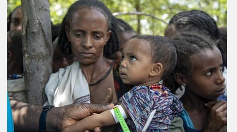 எத்தியோப்பியாவில் கடும் உணவுப் பஞ்சம்: 1 லட்சத்துக்கும் அதிகமான குழந்தைகளுக்கு ஊட்டச்சத்துக் குறைபாடு?