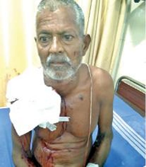 துப்பாக்கி சூட்டில் படுகாயமடைந்த விவசாயி பச்சையப்பன்.