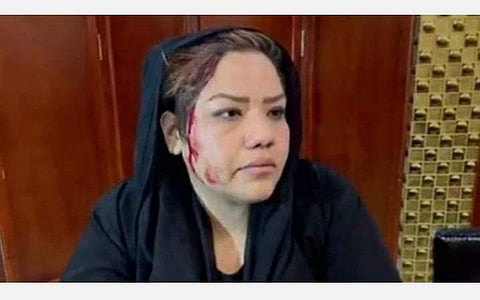 போராட்டம் நடத்திய பெண்கள் மீது தலிபான்கள் தாக்குதல்