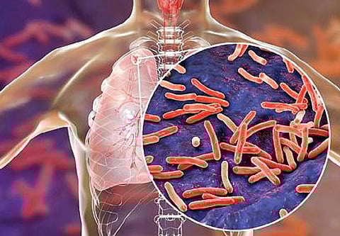 பி.சி.ஜி. தடுப்பூசிக்கு 100 வயது!