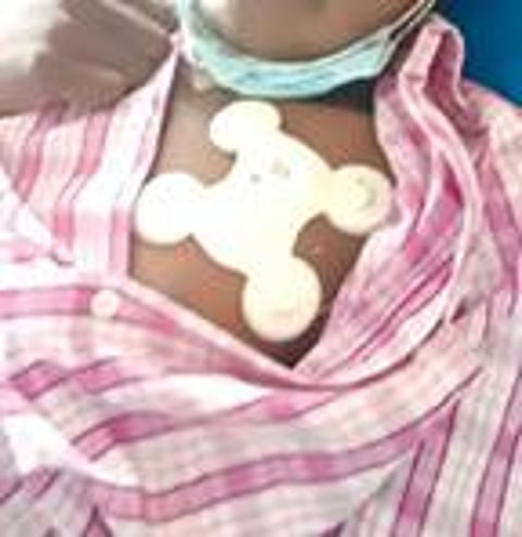 நாட்டிலேயே முதல் முறையாக பயோ சென்சார் கண்காணிப்புடன் கரோனா நோயாளிகளுக்கு சிகிச்சை தொடக்கம்: நவீனமாகும் மதுரை அரசு ராஜாஜி மருத்துவமனை