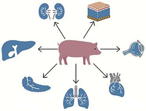 கதைப்போமா அறிவியல் 6: மனிதருக்குப் பொருந்துமா விலங்கு உறுப்பு?