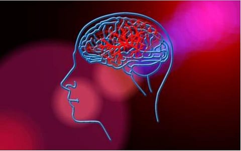 6 மணி நேரத்துக்குள் வந்தால் பக்கவாதத்தை குணப்படுத்தலாம்: வேலம்மாள் மருத்துவ கல்லூரி மருத்துவர்கள் நம்பிக்கை