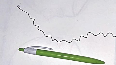 அவரின் காதில் சிக்கிய இரும்பு கம்பி