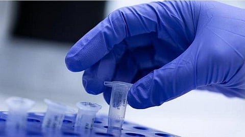 பிரதிநிதித்துவப் படம்