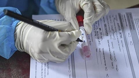 மீண்டும் 30,000ஐ தொட்ட அன்றாட கரோனா பாதிப்பு: பரவல் விகிதம் 2.45% ஆக அதிகரிப்பு