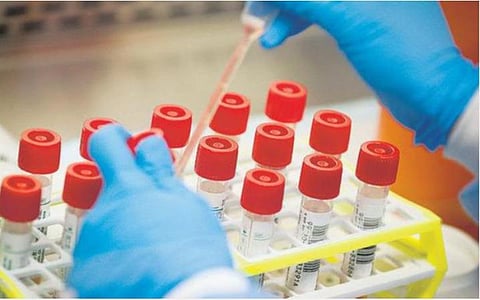 அறிகுறிகள் இல்லாதவர்களுக்கு தேவையின்றி கரோனா தொற்று பரிசோதனை செய்யக் கூடாது: பொது சுகாதாரத் துறை இயக்குநர் அறிவுறுத்தல்